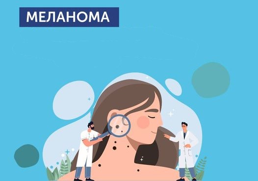 До Уваги! День меланоми!